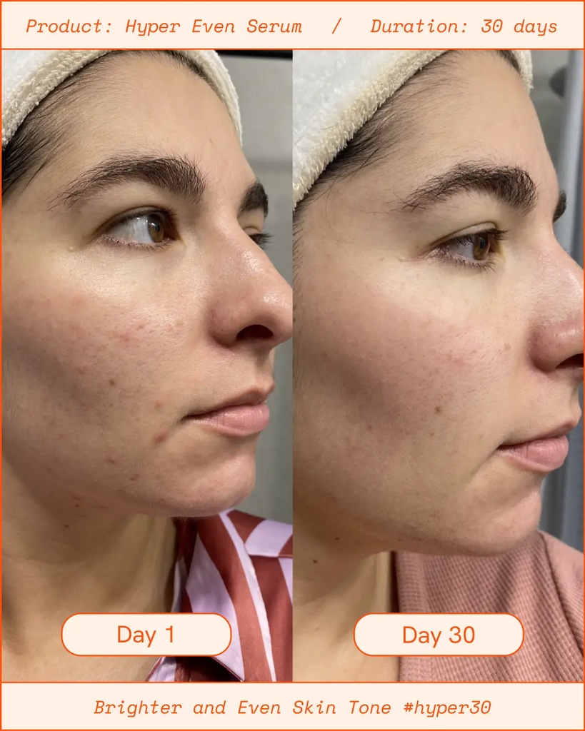 Hyper Even Brightening Dark Spot Vitamin C Serum